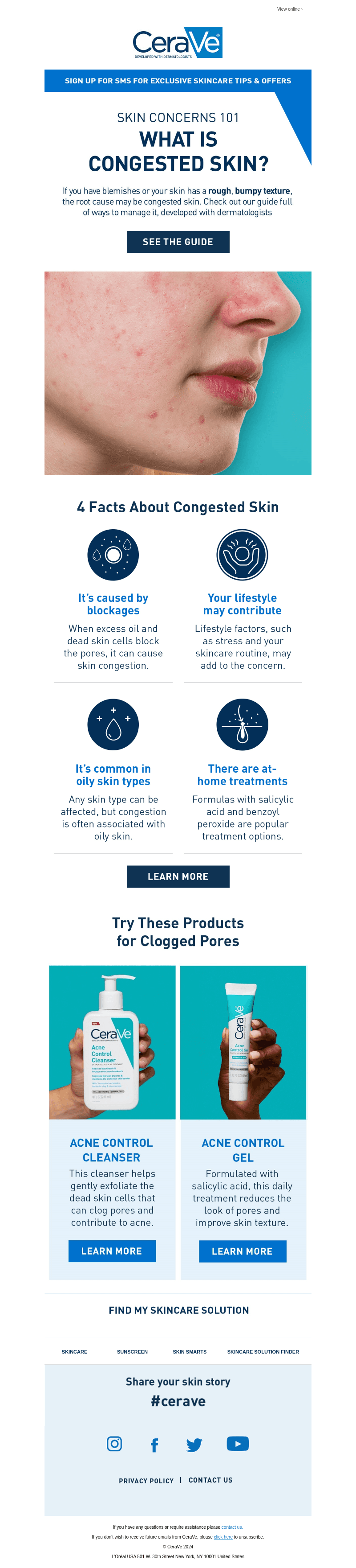 What is Congested Skin & Do You Have It?